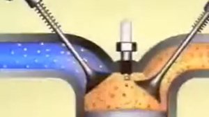 TOYOTA  VVT i   Механизм газораспределения с изменяемыми фазами