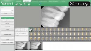 Ez Dent-i Program Программа Ez Dent-i