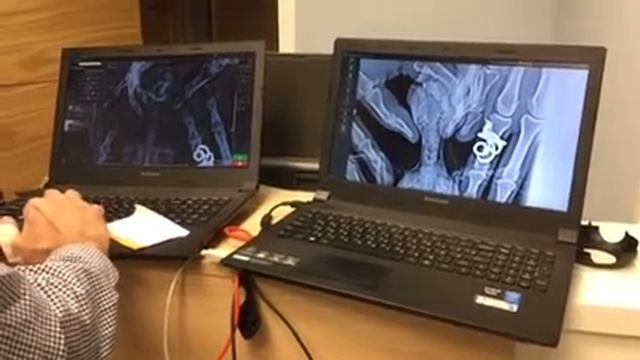 Сравнение рентгенограмм CR и DR смотреть онлайн