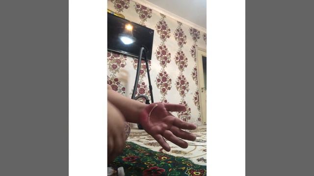 Күйік шалу алғашқы көмек смотреть онлайн