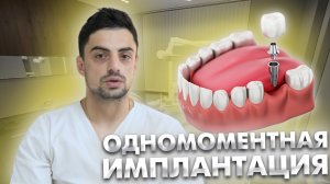 В каких случаях вы рекомендуете одномоментную имплантацию?