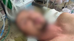 Военные медики Тульского соединения ВДВ  провели уникальную операцию в зоне СВО.