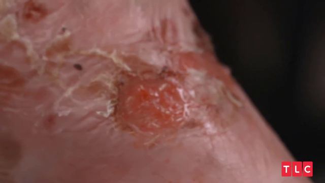 My Feet Are Killing Me INSANE Moments! SUPER GROSS!! (Part 19) смотреть онлайн