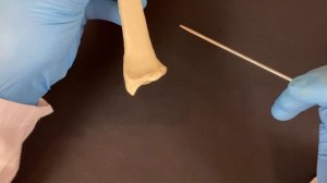 Лучевая кость - Radius (анатомия человека)