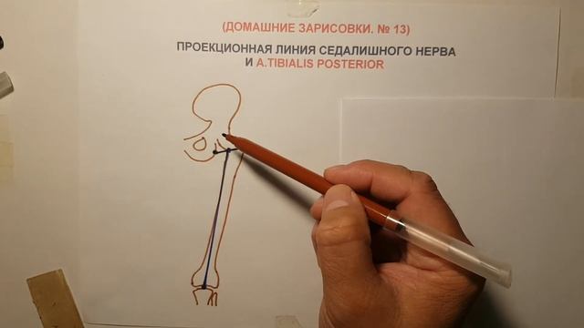 ПРОЕКЦИЯ СЕДАЛИЩНОГО НЕРВА