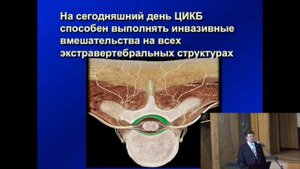 Мультидисциплинарный подход к лечению хроническ(3).mp4