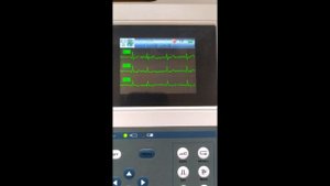 Электрокардиограф трехканальный BE300