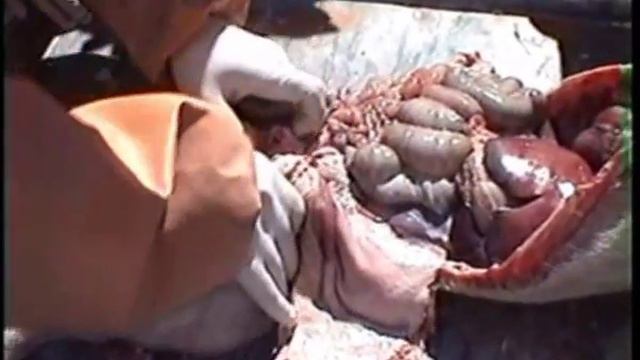 Розтин тазової порожнини. Вскрытие тазовой полости. смотреть онлайн