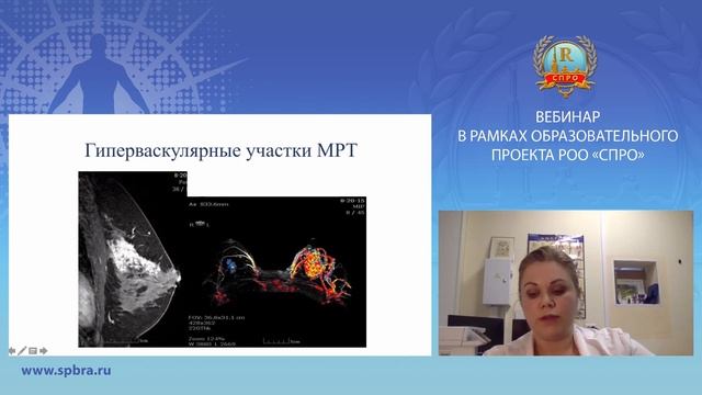Мультимодальная визуализация молочных желез: за и против
