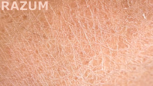 Топ 10 признаков больных почек смотреть онлайн