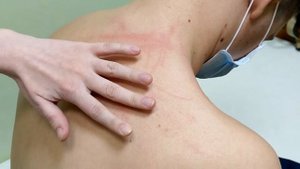 Определение верхней границы легких (сзади)