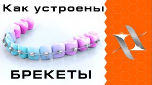 КАК РАБОТАЮТ БРЕКЕТЫ. Устройство брекет-системы.
