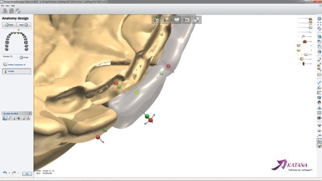 How to design Digital Veneers in 3Shape (2) смотреть онлайн