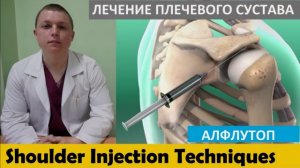 Локальная инъекция Лечение боли в плече АЛФЛУТОП Subacromial Shoulder Injections