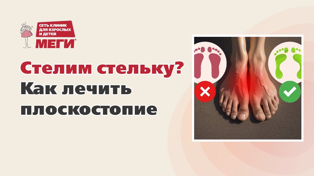 Зачем лечить плоскостопие?