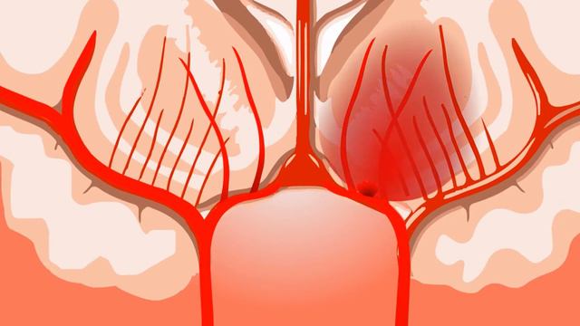 Cахарный диабет смотреть онлайн