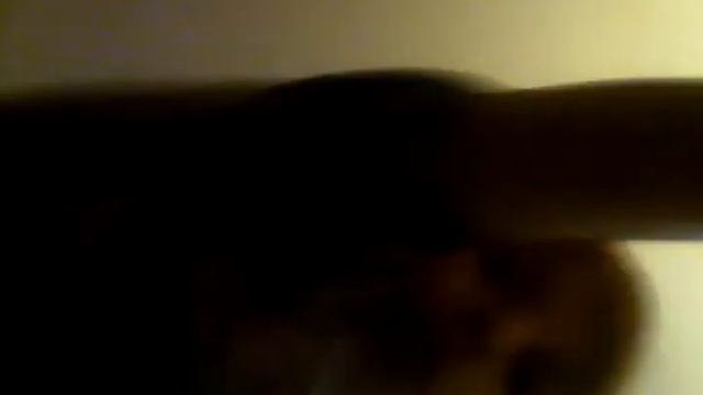 Перелом пальца😭🙏😫🙅 смотреть онлайн