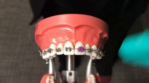 Цветные резинки для брекетов