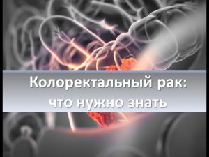 Что нужно знать о колоректальном раке