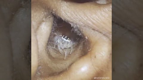 под микроскопом