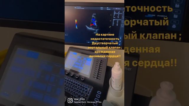 недостаточность Двустворчатый аортальный клапан;  врожденной патология🫀الصمام الأبهري ثنائي الشرف