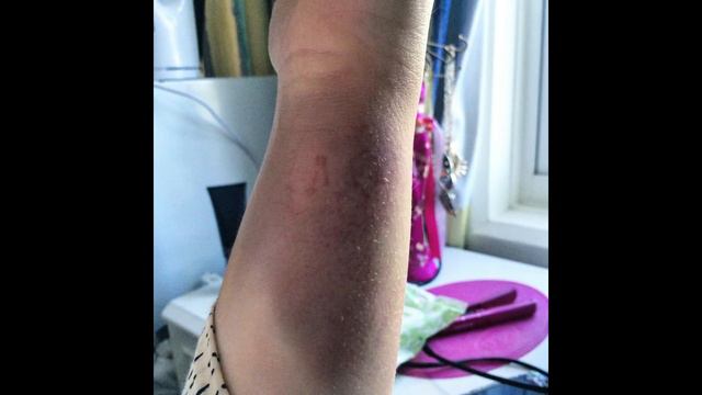 I was ASSAULTED because of my DISABILITY (Storytime)| Hate Crime| Wheelchair Life| ALifeLookingUp смотреть онлайн