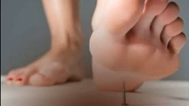 Ваше здоров'я. "Чим небезпечний правець" смотреть онлайн