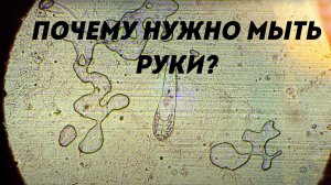 Микробы на руках под микроскопом | Почему нужно мыть руки?