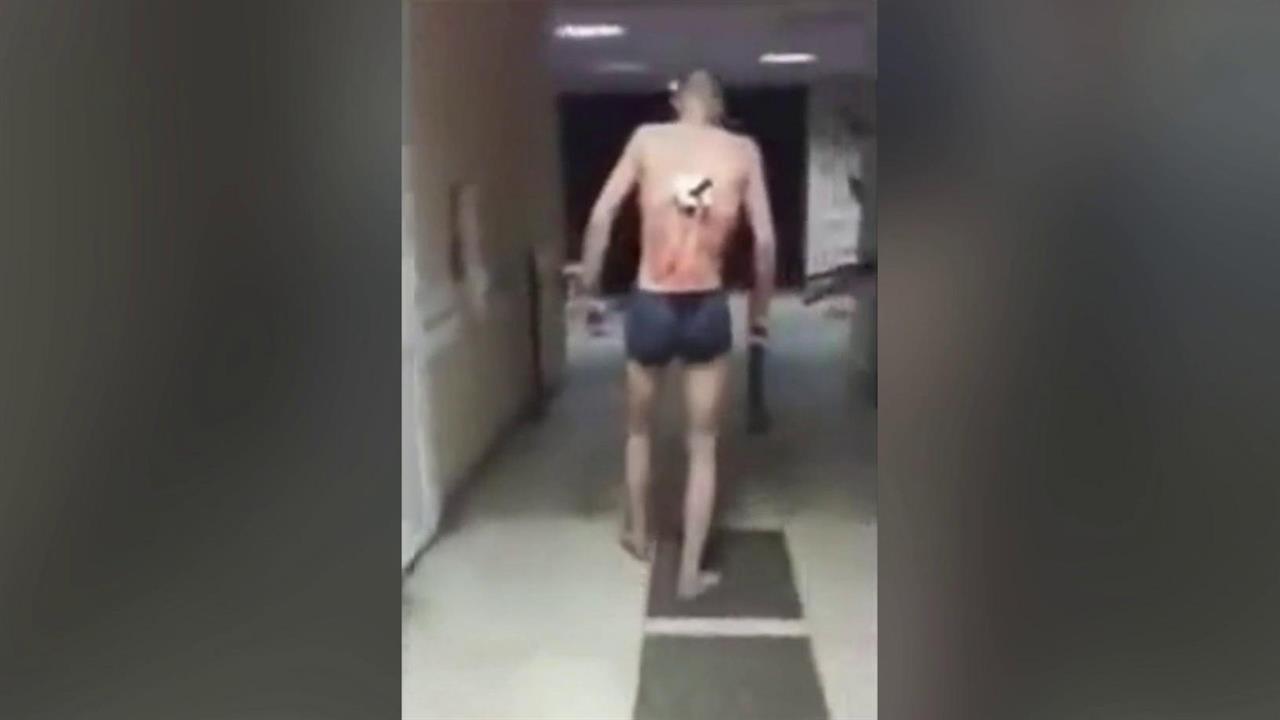 В больнице Зеленодольска мужчина с ножом в спине вышел покурить