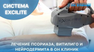 Лечение псориаза, витилиго и нейродермита аппаратом EXCILITE в ОН КЛИНИК