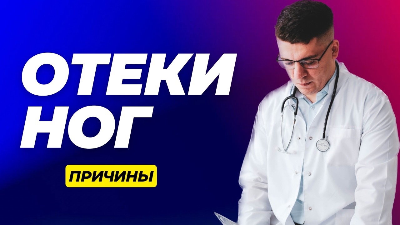 ОТЕКИ НОГ