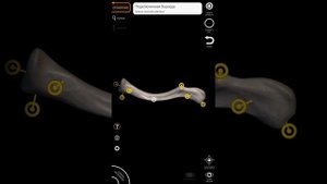 Лопатка и ключица (акромиально-ключичный сустав)