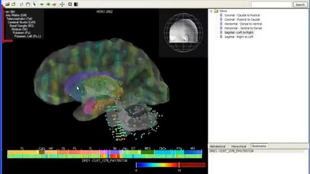 Tutorial: Brain Explorer® 3-D Viewer for the Allen Human Brain Atlas