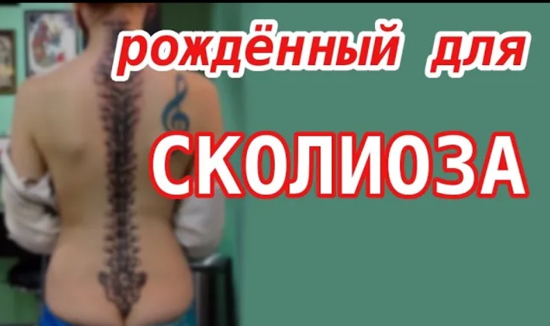 Сколиоз у детей. Сколиоз как исправить. Сколиоз как лечить у взрослых