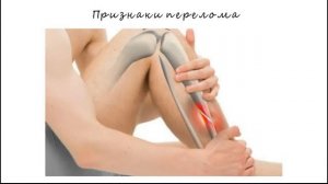 13 урок Оказание первой медицинской помощи при переломах