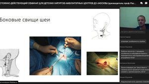 Срединные и боковые кисты и свищи шеи часть 2