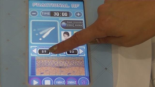 видеообзор на аппарат фракционного микроигольчатого RF лифтинга Nova NV-V400