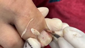 How to Repair Nails easy #330 - Xuyen Nail