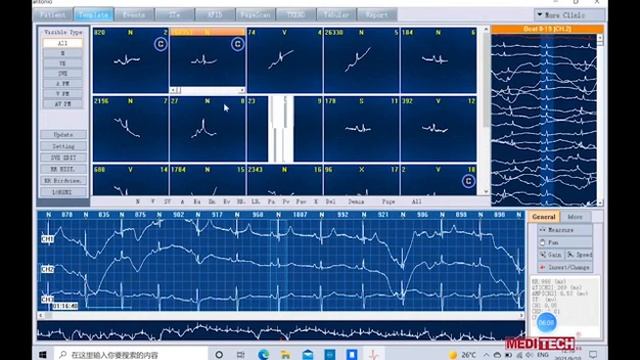 How to use the software of ECG Holter, Model Heartrec PRO/Lite -Part1 смотреть онлайн