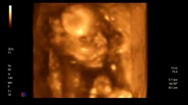 Renny-2 смотреть онлайн