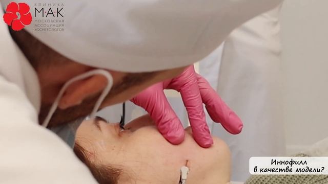 Иннофилл в качестве модели? смотреть онлайн