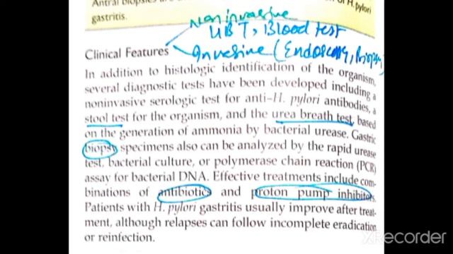 GIT Pathology 5 Major Topic: H.pylori Gastritis смотреть онлайн