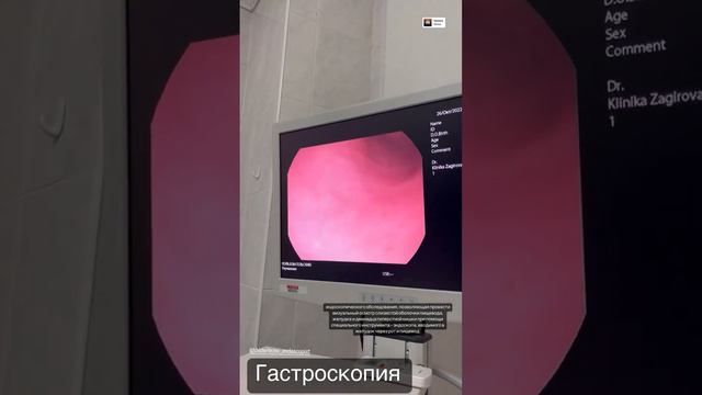 Гастроскопия