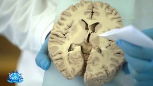 Базальные ядра головного мозга |Лекция