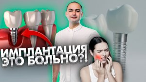 Имплантация зубов - это больно?