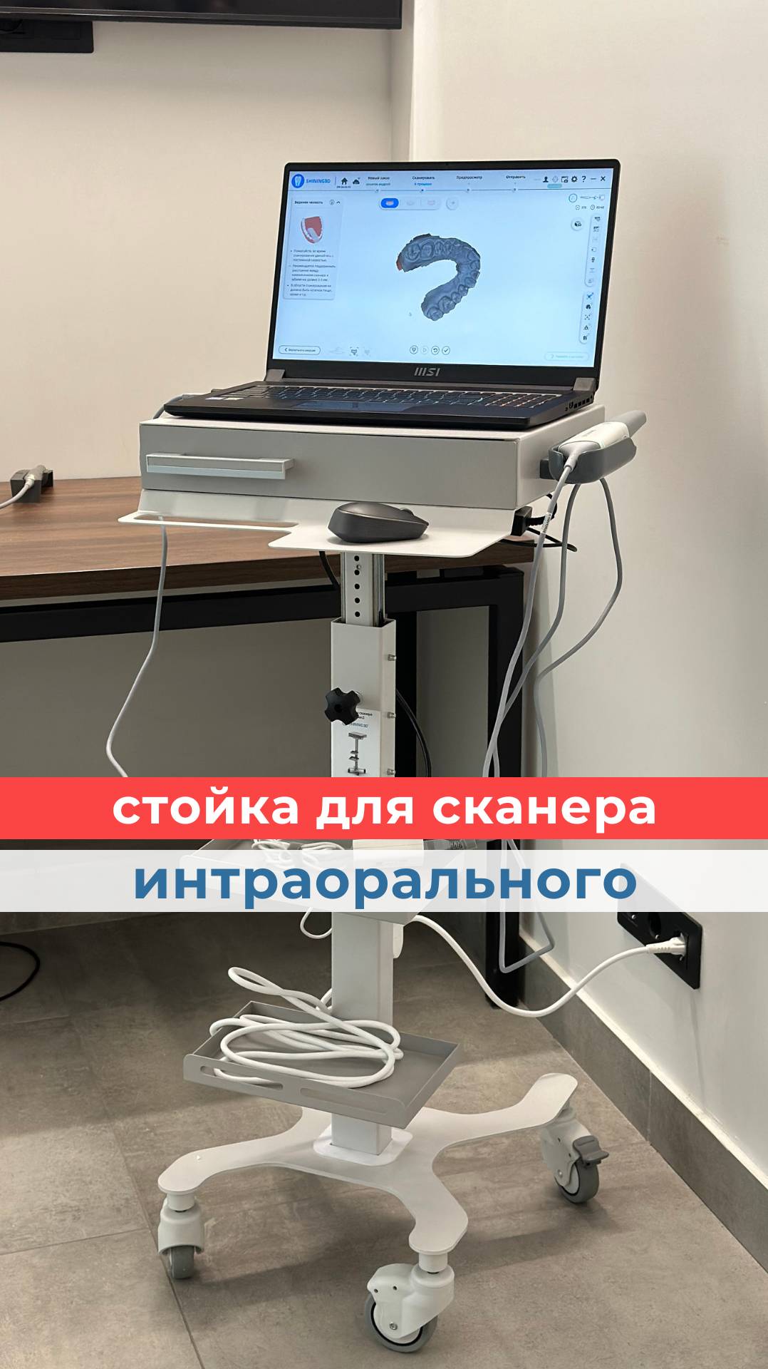 💡 Эргономичная стойка для интраорального сканера