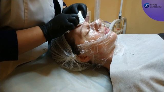 Ультразвуковая и механическая чистка лица смотреть онлайн