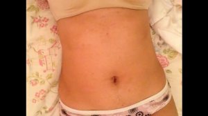 Friend's Stomach Sounds