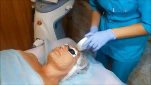 Элос омоложение