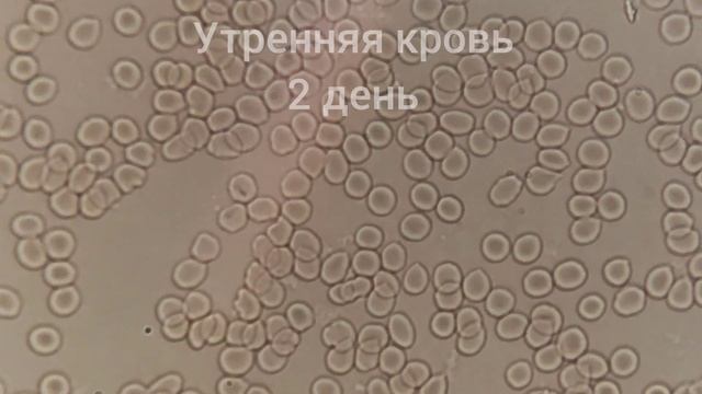 Кровь после 2,5 суточного голодания и очищения кишечника смотреть онлайн